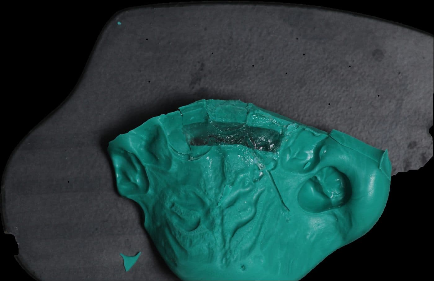 A green laboratory putty index of the upper arch with a rectangular window cut across the front teeth and clear silicone set into it, so curing light can reach the fibre while the index holds it in place.